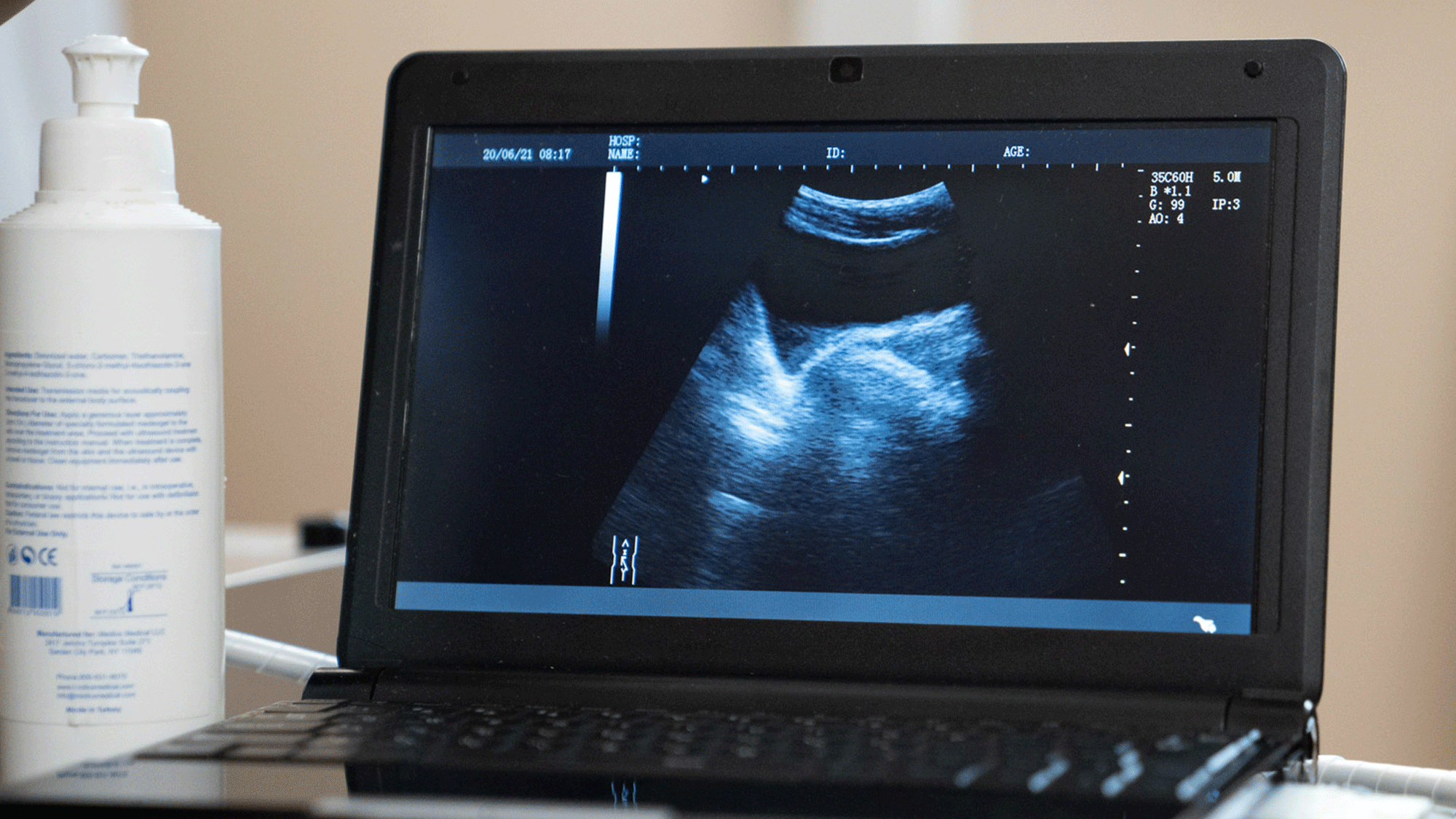 Ultrasound Of Anal Sex - Here's What An Ultrasound Of Someone Getting Butt Fucked Looks Like -  TheSword.com