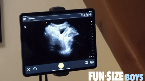 600px x 334px - The Dick-In-Ass Ultrasound Just Made Its Gay Porn Comeback - TheSword.com